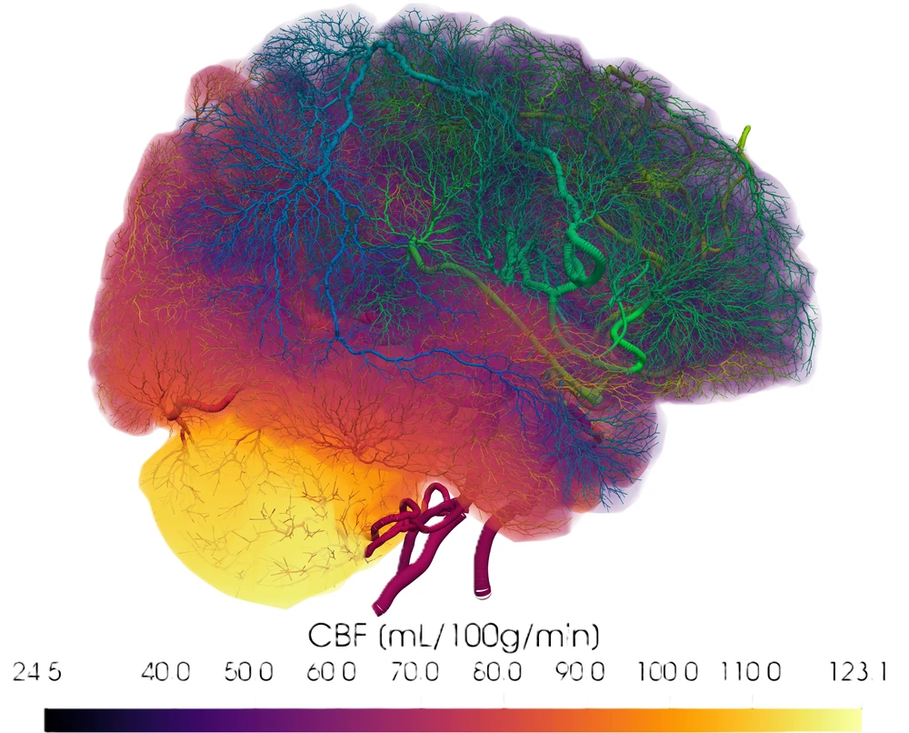 A brain with its arteries and tissue perfusion field, systemic pressure changing, arteriolar diameter answering, and perfusion returning to its regulated range
