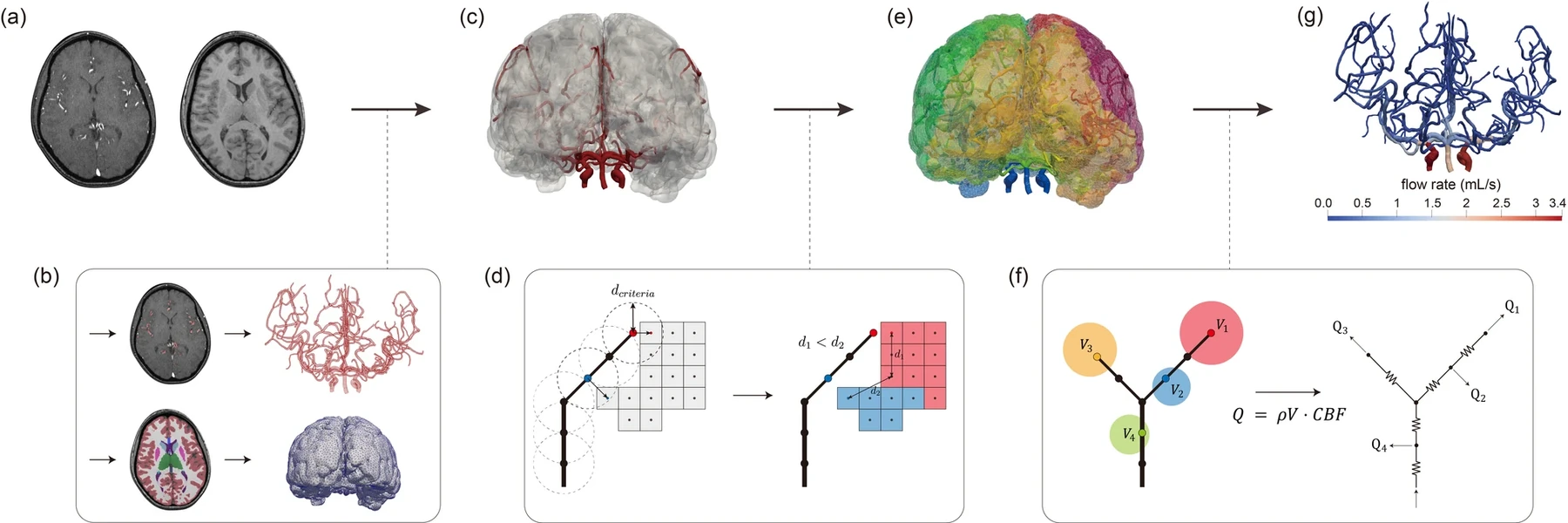 MRI and MRA → vessel and tissue segmentation → artery–tissue association → perfusion territories coloured and labelled as territories, not as flow → the resulting flow distribution across the major arteries