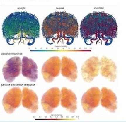 Supine, upright and inverted side by side, each with arterial and venous pressure and total vascular volume beneath, and autoregulation enabled against disabled as two curves