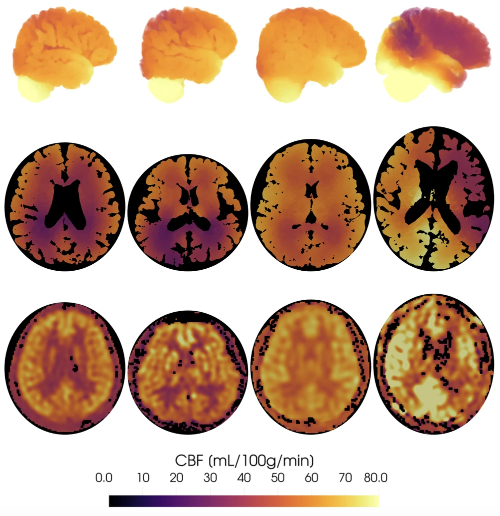 The synthetic vascular network, the arterial pressure distribution along it, and the three-dimensional cerebral blood-flow field — with simulated perfusion set against arterial spin labeling MRI on one shared colour scale
