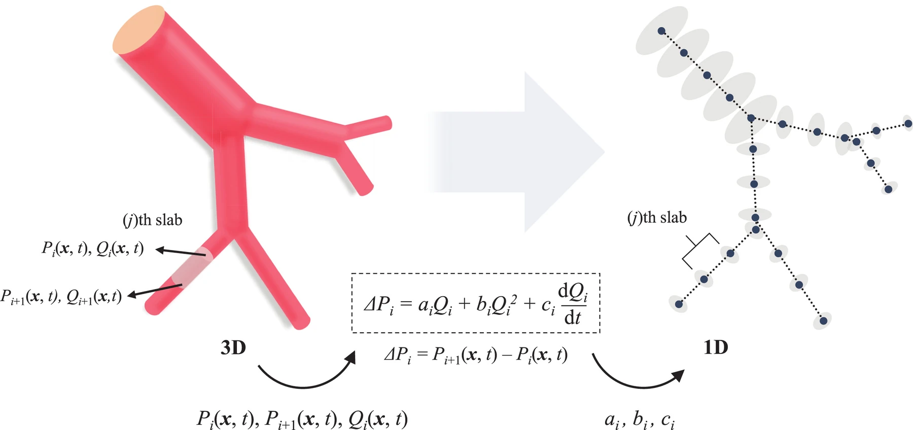 Coronary CTA → geometry reconstruction → 3D CFD calibration → 1D reduced-order model → pressure, flow and FFR
