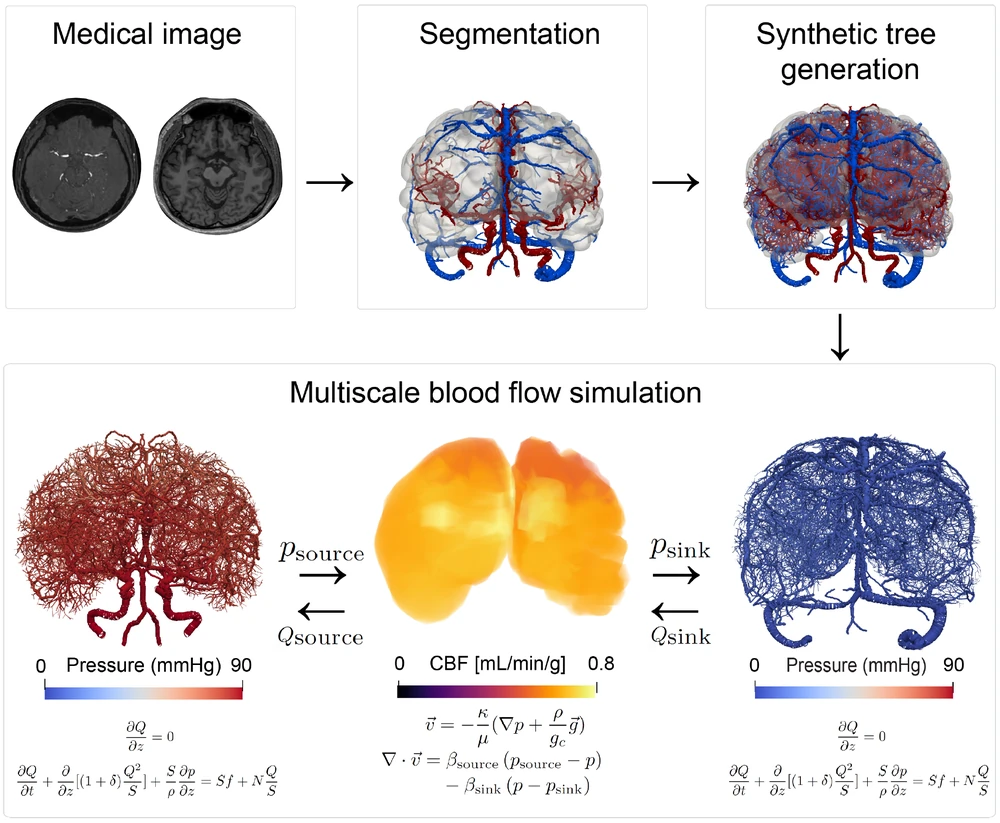 MRA → segmented major arteries → tissue domain → synthetic tree growth → the complete multiscale network, labelled as computational network generation