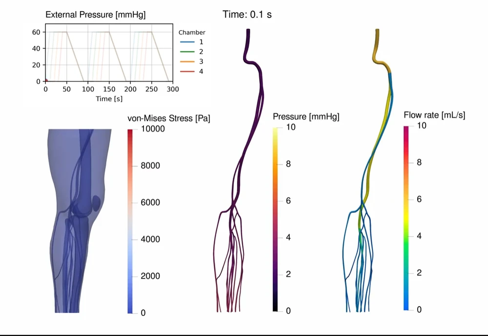The ramp-up, hold and release pressure waveform above; vein cross-sections at low and high pressure below it; and flow rate, pressure and wall shear stress compared at the foot