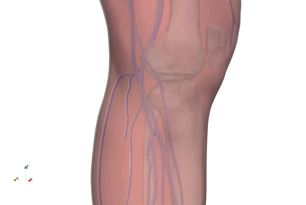 Subject-specific lower-limb geometry from medical images, tissue displacement before and during compression, and the venous pressure and flow-rate distribution at the same instant